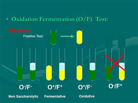 oxidation fermentation test|Oxidation Fermentation Test: Principles, Media, Enzymes, and .